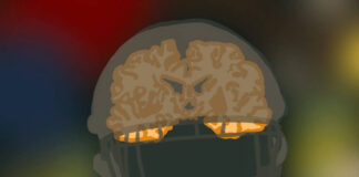 Column: CTE, the NFL’s most dangerous injury is invisible